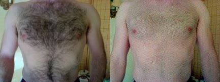 estética depilador(a) esteticista