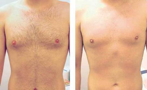 estética depilador(a) esteticista