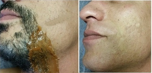 estética depilador(a) esteticista