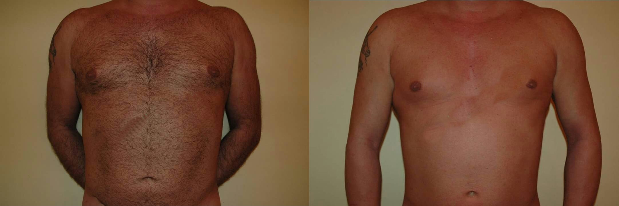 estética depilador(a) esteticista