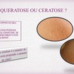 A ceratose ou queratose pilar é um disfunção estética ocasionada pela inflamação do folículo piloso e pode causar coceira e incomodo estético para muitas pessoas. Venha conhecer os tratamentos específicos para seu tipo de pele em Giulia Valvano Estética 