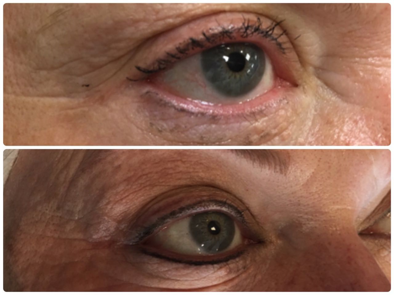 A micropigmentação no contorno dos olhos tem como finalidade realçar a beleza dessa região, dando mais suavidade e expressão ao olhar.
Este processo substitui o lápis e o delineador evitando borrões e retoques. Feito com uma aplicação sutil de pigmento entre os cílios e pode variar nas cores, espessura e comprimento, sendo infinitas as possibilidades estéticas.
Não percam tempo elaborando uma maquiagem e agende agora seu horário via whatsapp ou telefone📞(11) 98527-4762
#Micropigmentação #belezanatural #maquiagemperfeita #pmu #top #traçosfinos maquiagem micropigmentador(a) dermopigmentador(a)
