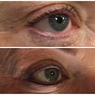 A micropigmentação no contorno dos olhos tem como finalidade realçar a beleza dessa região, dando mais suavidade e expressão ao olhar.
Este processo substitui o lápis e o delineador evitando borrões e retoques. Feito com uma aplicação sutil de pigmento entre os cílios e pode variar nas cores, espessura e comprimento, sendo infinitas as possibilidades estéticas.
Não percam tempo elaborando uma maquiagem e agende agora seu horário via whatsapp ou telefone📞(11) 98527-4762
#Micropigmentação #belezanatural #maquiagemperfeita #pmu #top #traçosfinos