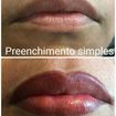 Independente da tendência e moda das cores, o batom será sempre um grande aliado das mulheres💄💄
Por uma questão de vaidade ou para correção de imperfeições causadas pelo envelhecimento cutâneo, acidentes que afetaram a região facial, ou alterações genéticas como fissuras labiopalatais, a micropigmentação é a solução para quem procura um resultado durável💋
Contorno e preenchimento simples; 3D ombrê; e 3 D ombrê sculptor ( iluminador que proporciona um efeito "lifiting").
#Micropigmentação #lábiosperfeitos #nadadebatom #diva #perfeição #studiobelezaperfeita