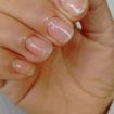 Alongamento estraga a unha natural. Não!!
Estraga se a preparação for feita errada. Estraga se a retirada for feita de forma agressiva.
Só temos um gel no Brasil que sai com a acetona (Soares off gel) e o acrílico pode ser retirado com acetona sempre! @jufernandesnails  
Essa cliente ficou 3 meses com o alongamento e vale ressaltar que ela estava com as unhas bem roidas.