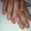 Quando uma cliente aparece assim....Já sabemos que ela sofre de onicofagia  (o hábito de roer as unhas) sabemos que isso atinge a auto estima dela fazendo com que não se arrume, não se sinta mulher, perca o seu poder de mulher.
Acredite unhas bem feitas são uma mudança  na auto estima.  Essa cliente trabalha com vendas e tinha vergonha de mostrar as mãos.  Vamos mudar isso!