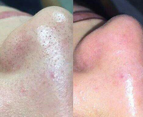 estética esteticista designer de sobrancelhas depilador(a)