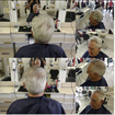 Corte de cabelo com disfarce da calvície na parte superior da cabeça.