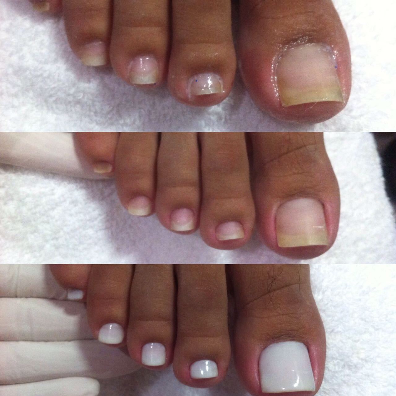 Antes, Durante e Depois..  unha manicure e pedicure recepcionista