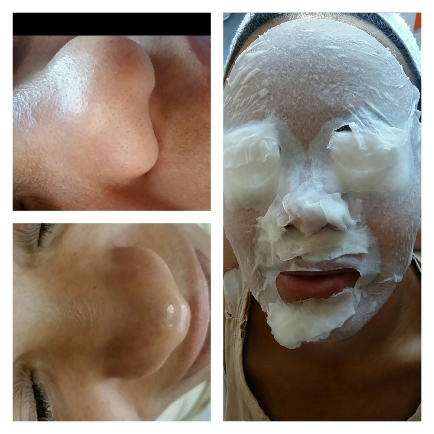 #limpezadepele estética esteticista