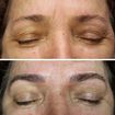 Microblading