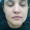 Antes make