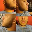 Barba