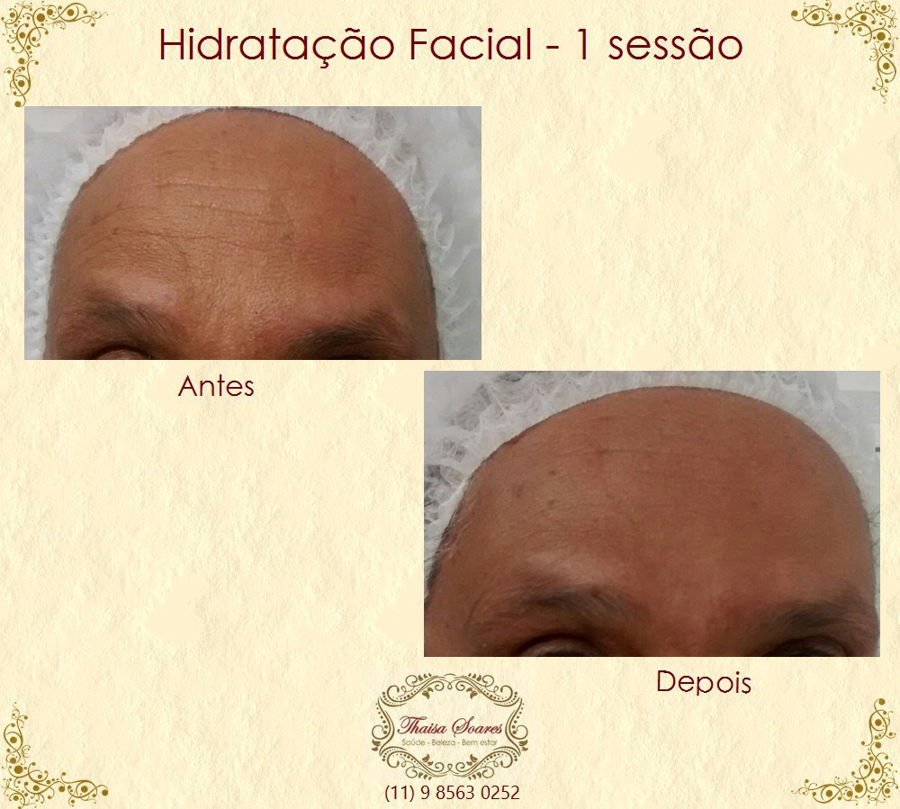 Hidratação facial estética esteticista designer de sobrancelhas