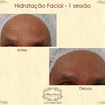 Hidratação facial