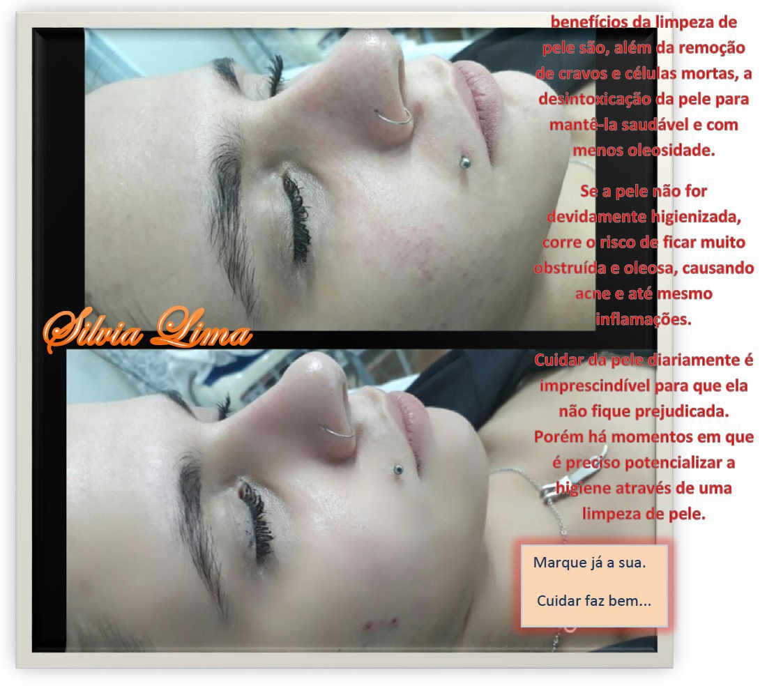 limpeza de pele estética esteticista