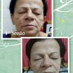 Tratamento de revitalização com microcorrentes