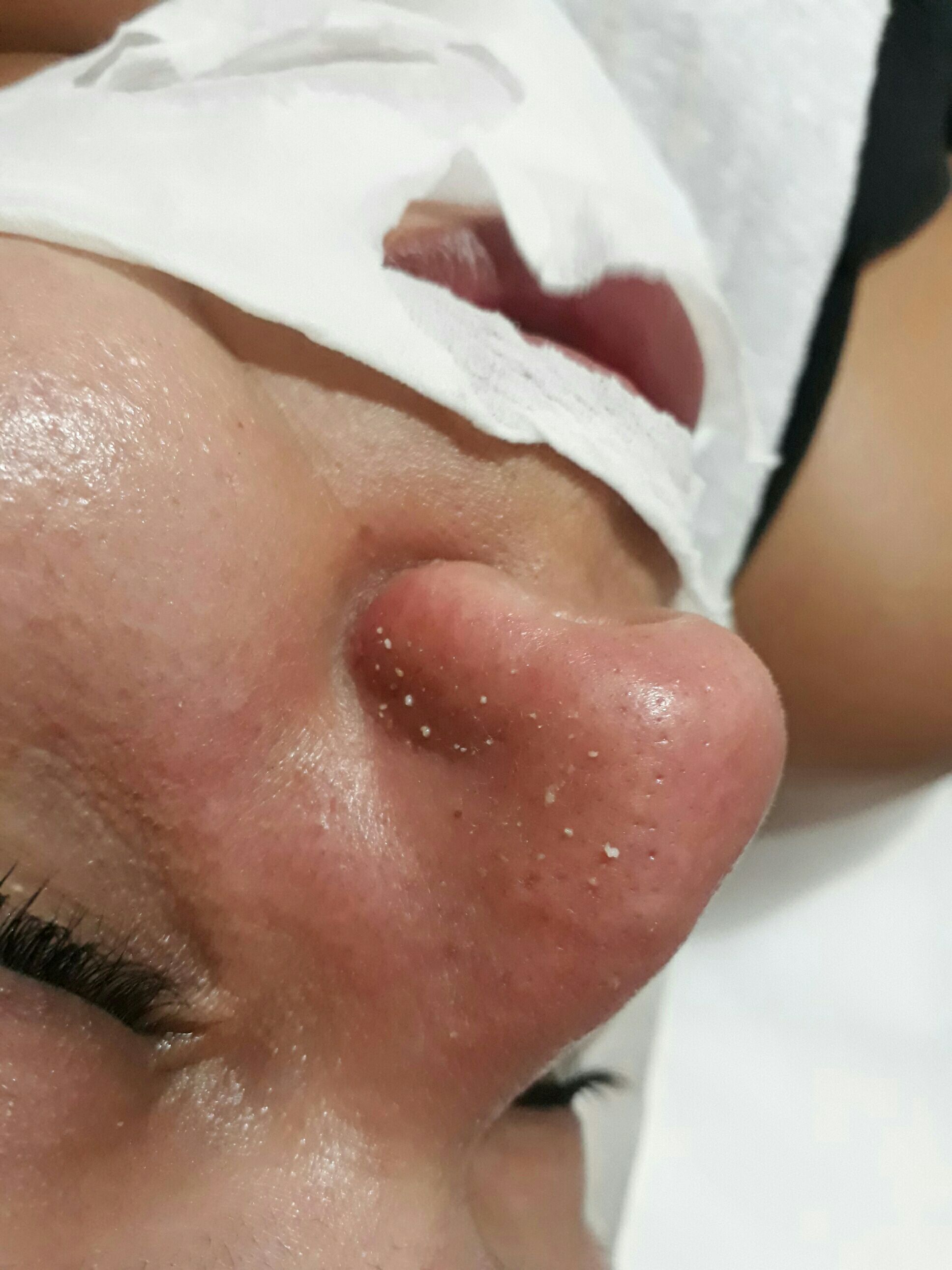 Limpeza de pele 😍 estética esteticista designer de sobrancelhas