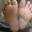 Podologia: antes e depois