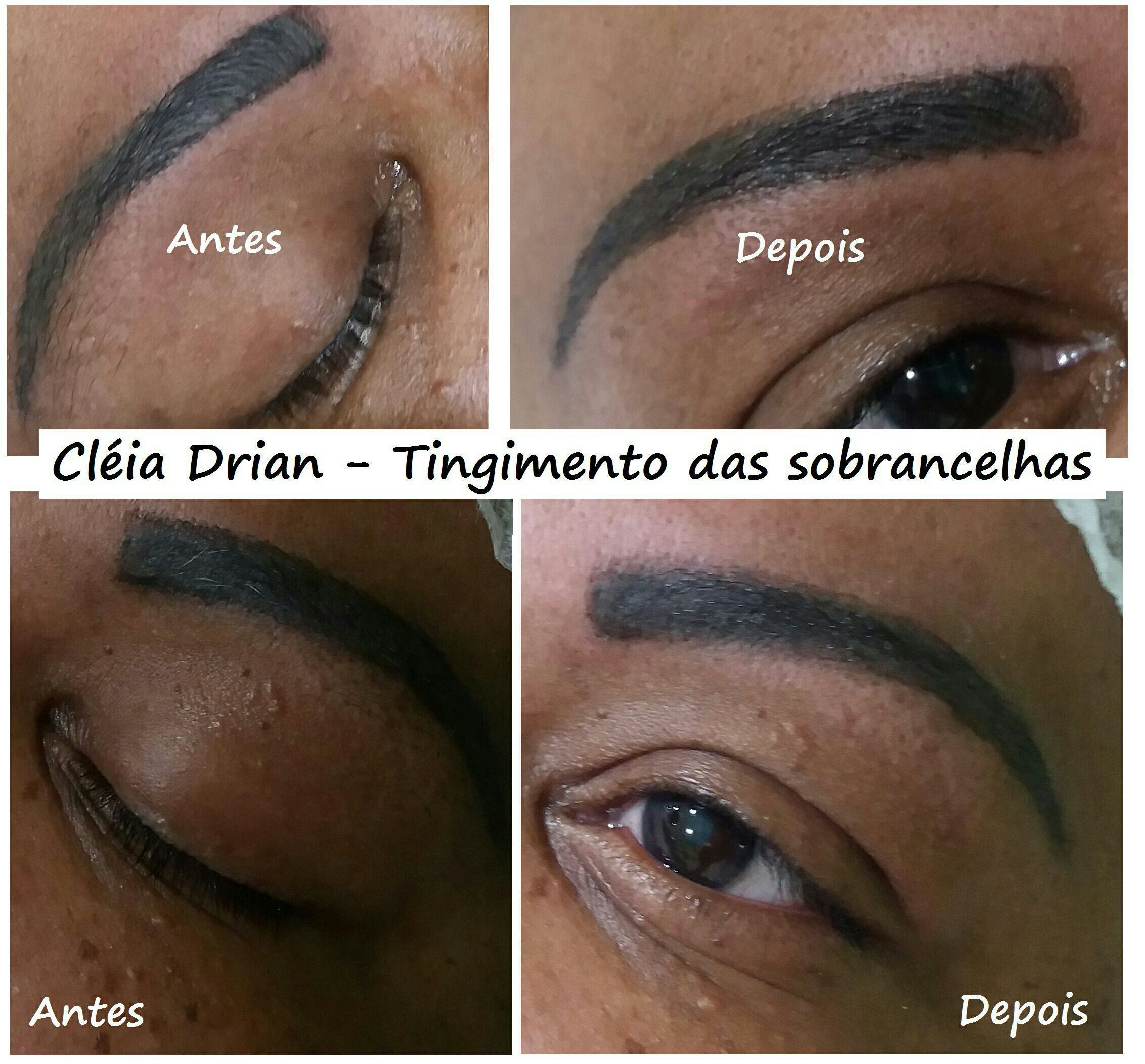 Tingimento das sobrancelhas que tinha fios brancos e micropigmentação antiga de tonalidade azulada. outros micropigmentador(a) designer de sobrancelhas