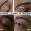 Tingimento das sobrancelhas que tinha fios brancos e micropigmentação antiga de tonalidade azulada.