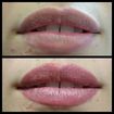 Micropigmentação labial 💋💋💋
**ANTES | RESULTADO CICATRIZADO**
(Sem retoque)
Técnica que permite corrigir assimetrias e tonalidade com naturalidade, como se fosse a cor dos seus lábios, porém com contorno bem definido e bem desenhada, viçosa e além de tudo com aspecto saudável. 
😍 Quem ja não quer acordar assim? — em Fernanda Marinho Micropigmentação.

