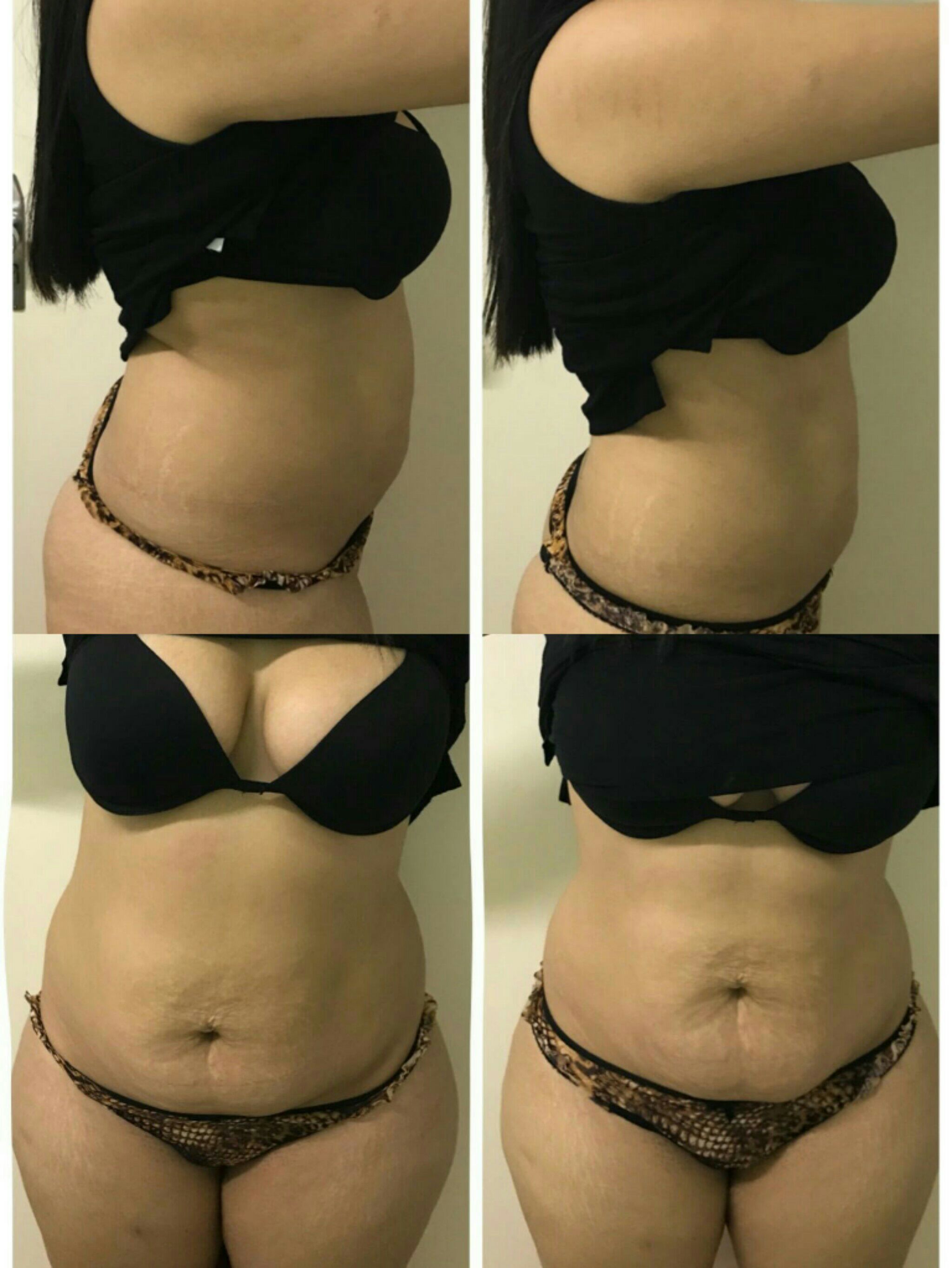 esteticista
