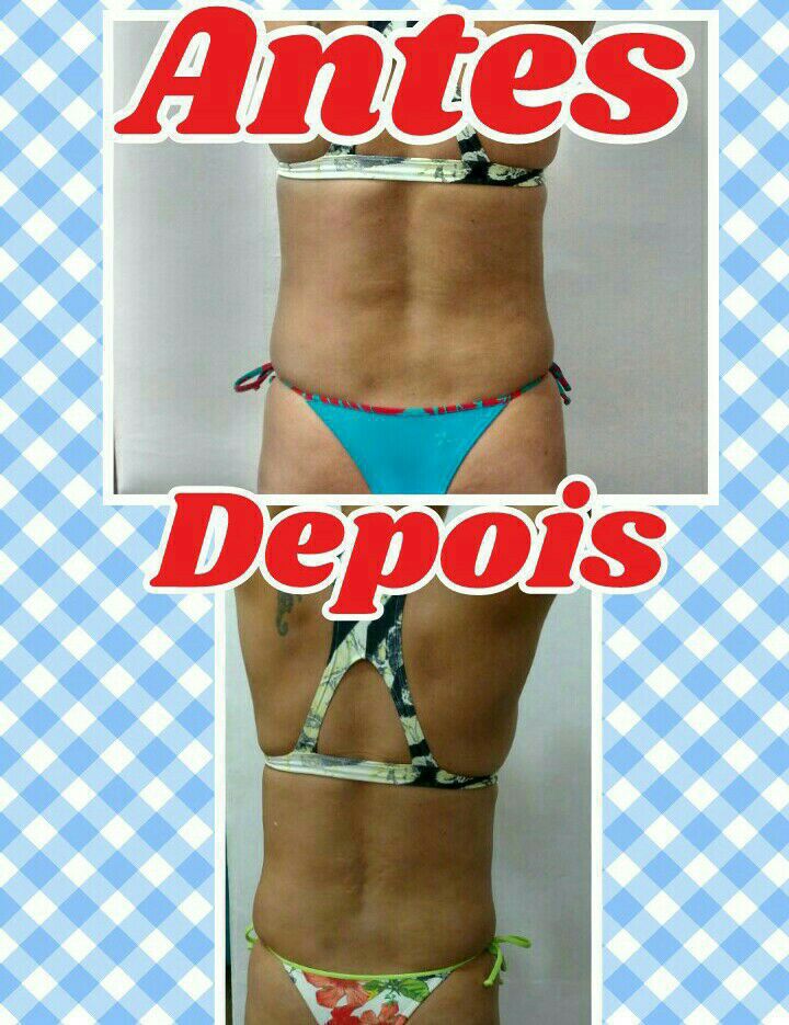 estética fisioterapeuta fisioterapeuta fisioterapeuta fisioterapeuta fisioterapeuta fisioterapeuta