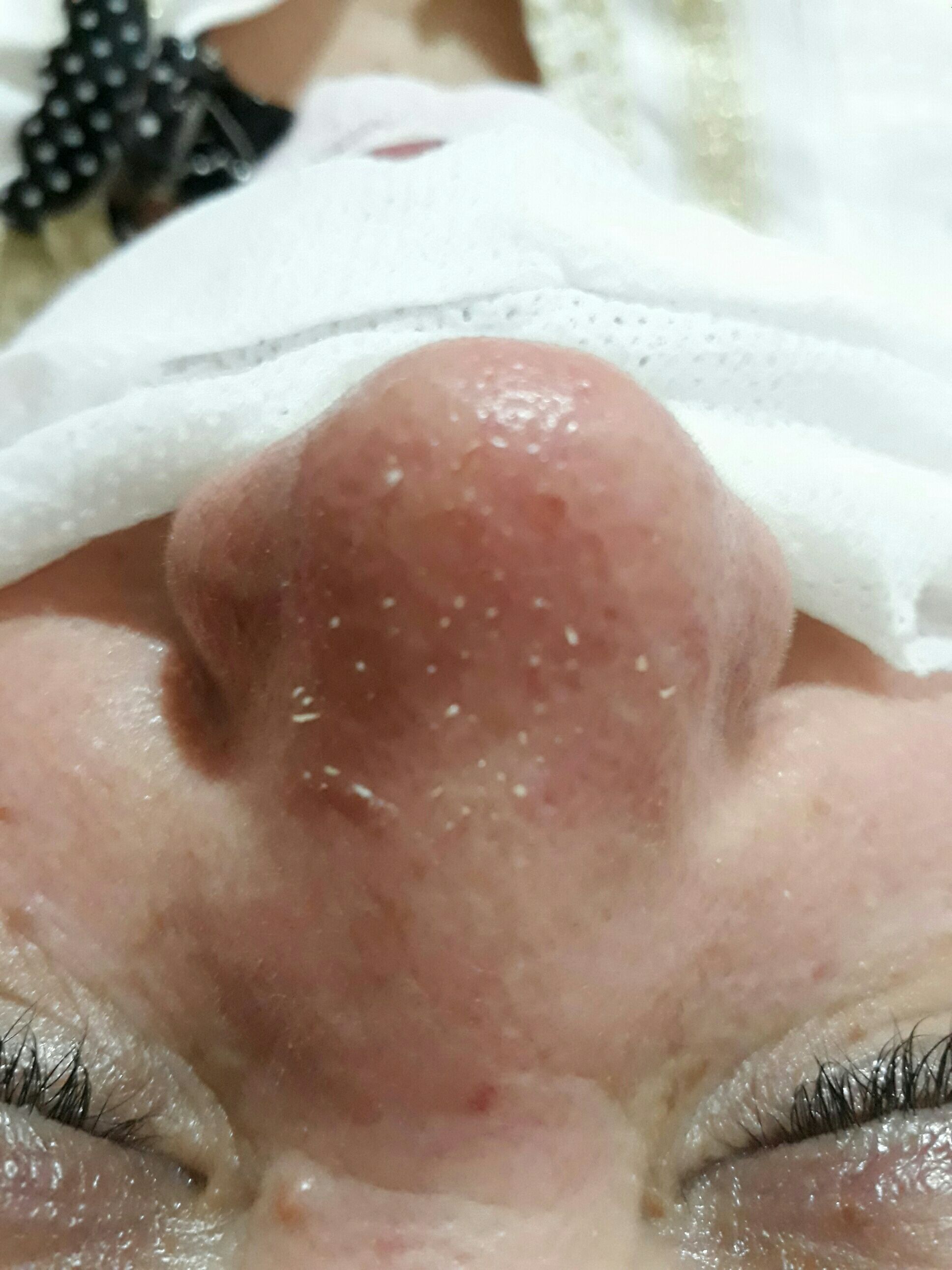 Limpeza de pele profunda estética esteticista designer de sobrancelhas