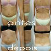 Realizado 10 sessões de crioterapia em conjunto com a massagem modeladora e o detox da região abdominal. 