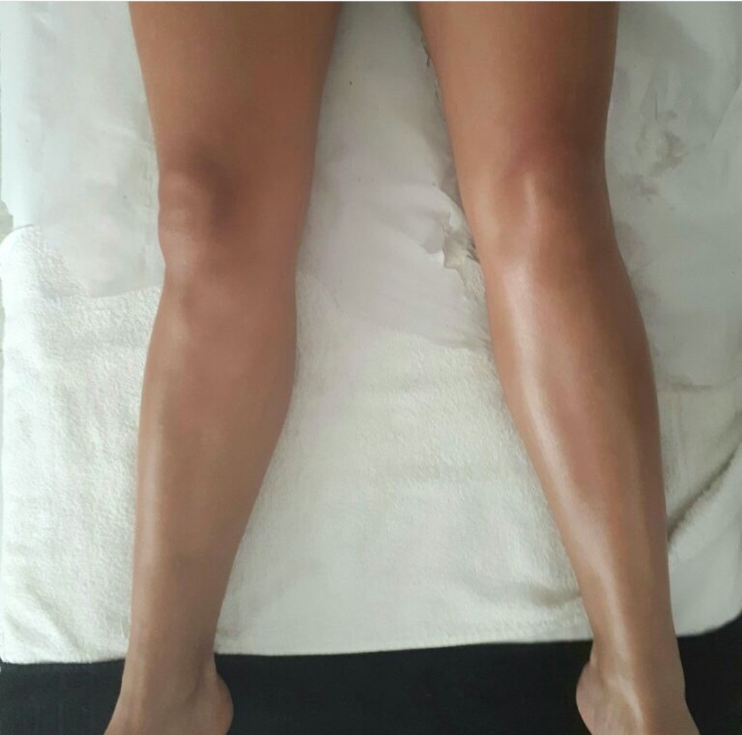 Drenagem lipodetox resultado isivrl na primeira sessão. estética esteticista massoterapeuta designer de sobrancelhas depilador(a)
