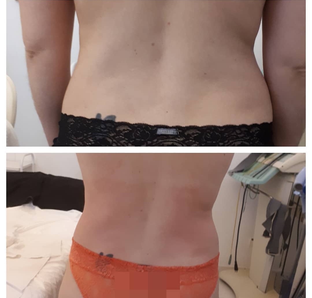Tratamentos exclusivos para cada cliente ressaltado apos 5 sessões.  estética esteticista massoterapeuta designer de sobrancelhas depilador(a)