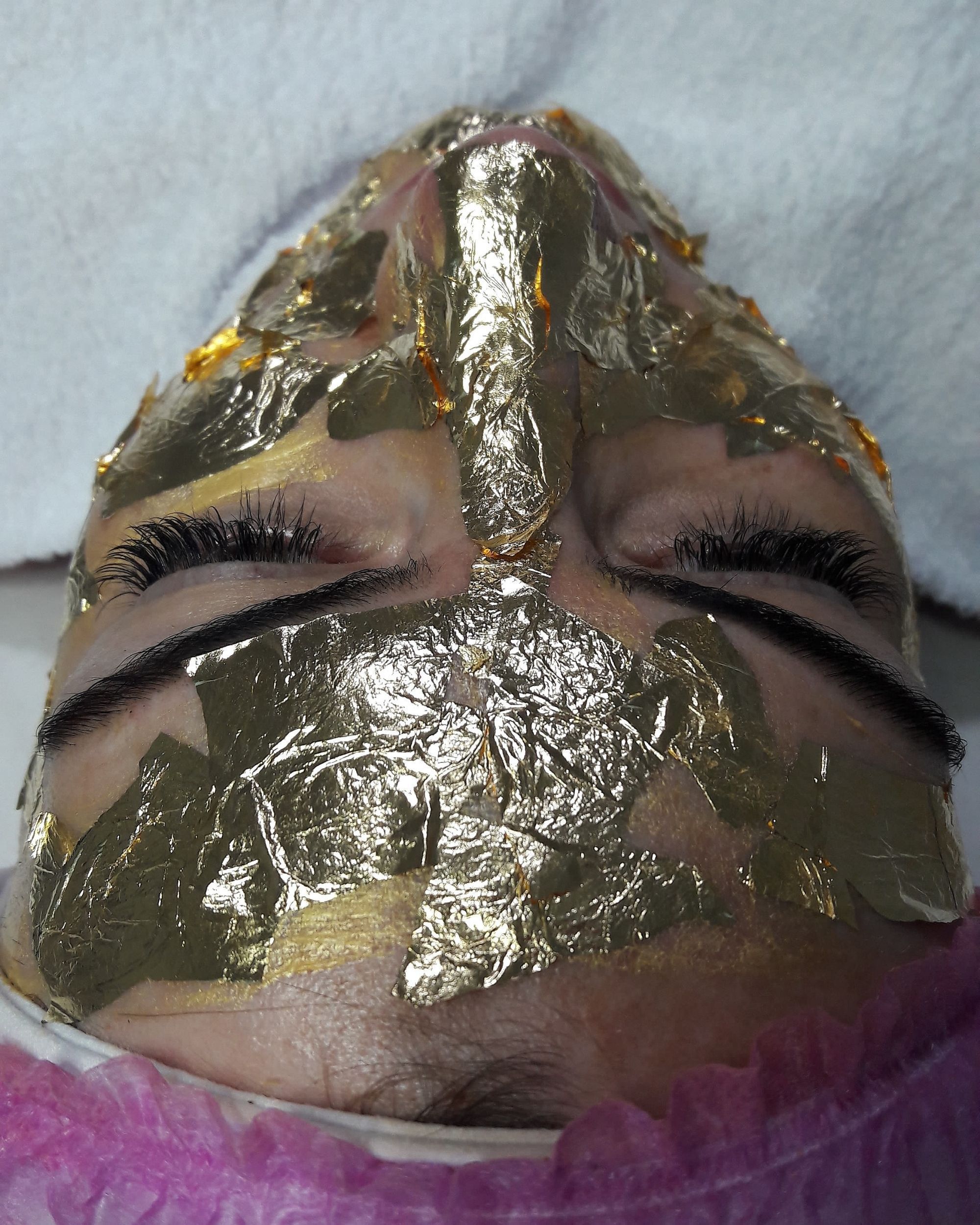 Limpeza de pele profunda associada com peeling diamantado e mascara de ouro esteticista