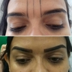 Microblading