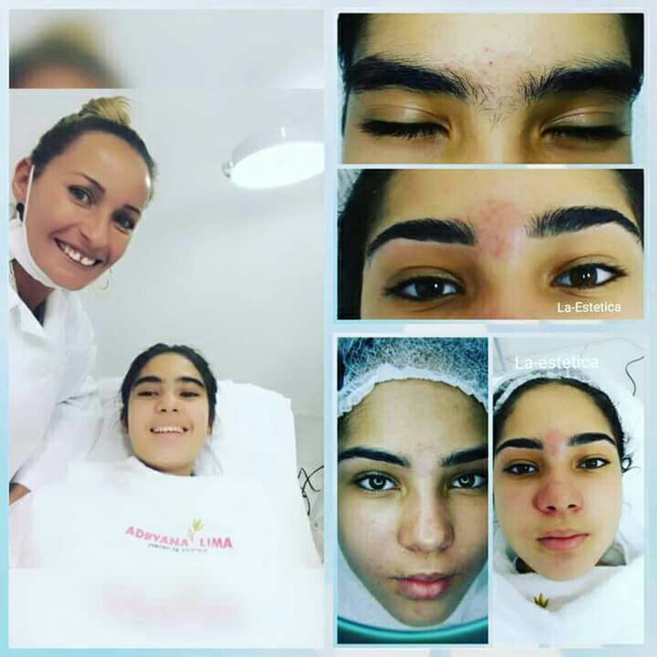 Limpeza de pele estética esteticista micropigmentador(a) cabeleireiro(a) designer de sobrancelhas maquiador(a) depilador(a) cosmetólogo(a)