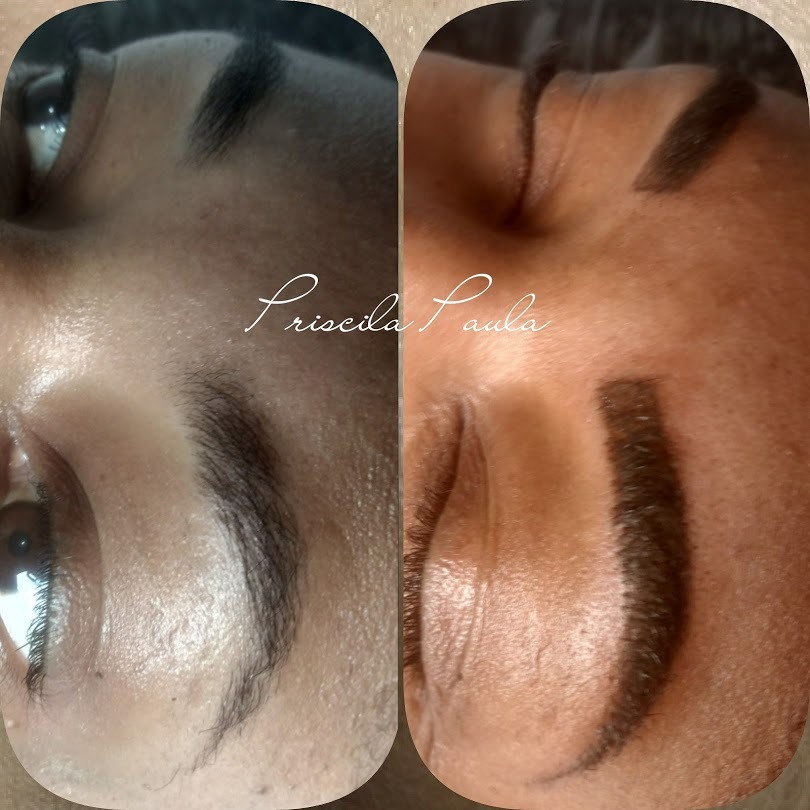 Tecnica esfumada

Procesimento indolor.

A cor clareia em torno de 30% após a cicatrização, deixando o aspecto mais natural.
Duração de 1 a 2 anos.

📍 Marque já seu horário: 11 95291 0704

# esfumada #fioafio #designerdesobrancelhas #eyebrow #micropigmentação #dermopigmentação #sobrancelhas #ironworks estética micropigmentador(a) designer de sobrancelhas