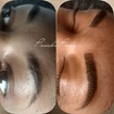 Tecnica esfumada

Procesimento indolor.

A cor clareia em torno de 30% após a cicatrização, deixando o aspecto mais natural.
Duração de 1 a 2 anos.

📍 Marque já seu horário: 11 95291 0704

# esfumada #fioafio #designerdesobrancelhas #eyebrow #micropigmentação #dermopigmentação #sobrancelhas #ironworks