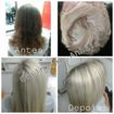 Mechas (Touca) + Tratamento
