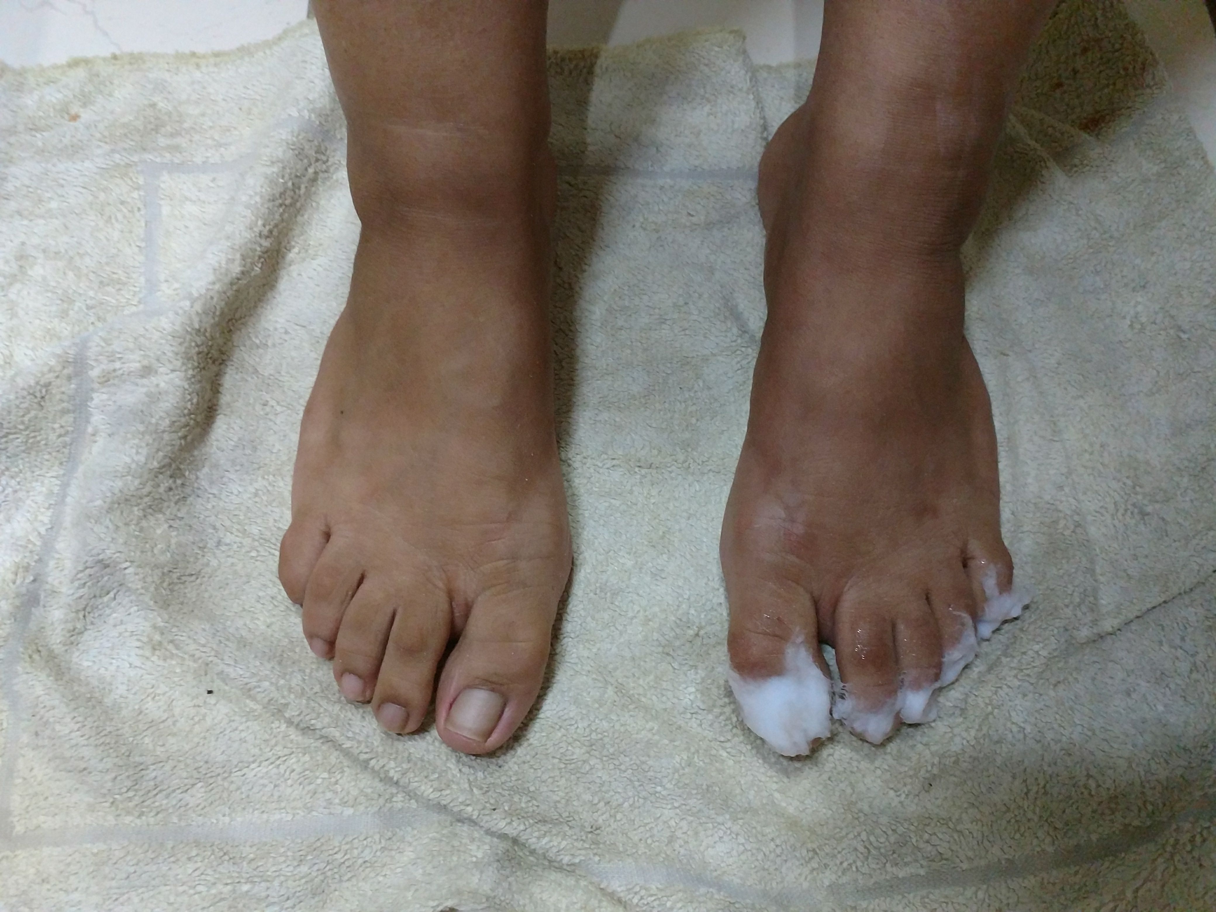 #esfoliação ..... Esfoliação faz toda diferença. Pé sem algodão com esfoliação/com algodão, sem esfoliação. estética manicure e pedicure
