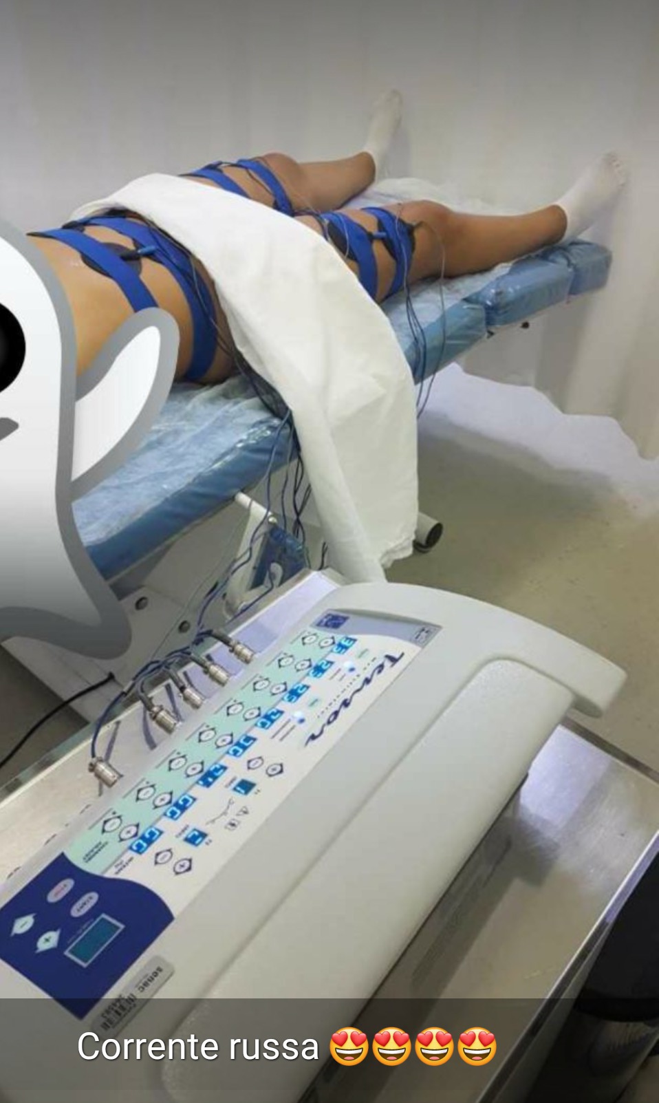Corrente Russa:
Contribui para a definição e o estimulo mais rápido dos músculos. Ela ajuda a aumentar o volume muscular, na circulação sanguínea.  #correnterussa #musculotonificado #eletroterapia  estética esteticista assistente esteticista designer de sobrancelhas