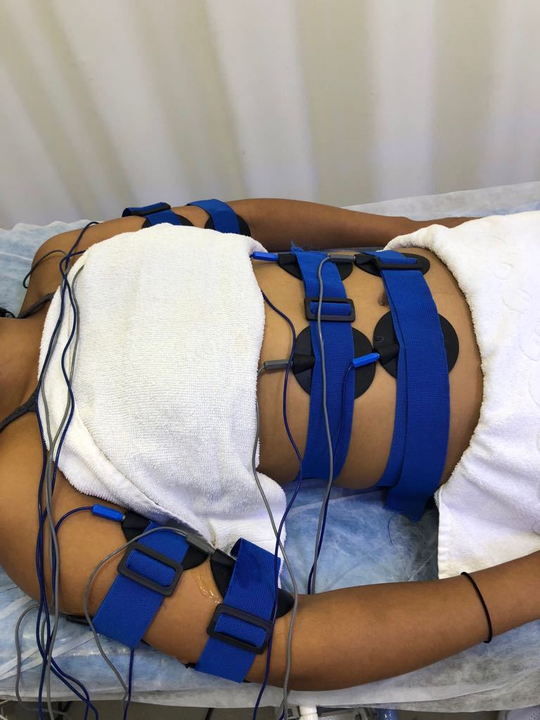 Eletroterapia - Corrente Russa trabalhando gordura localizada.  estética esteticista assistente esteticista designer de sobrancelhas