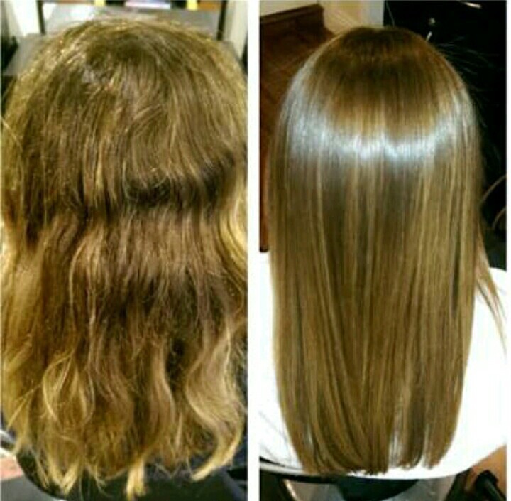 Antes e depois de um botox  Capilar  cabelo auxiliar cabeleireiro(a) maquiador(a) recepcionista