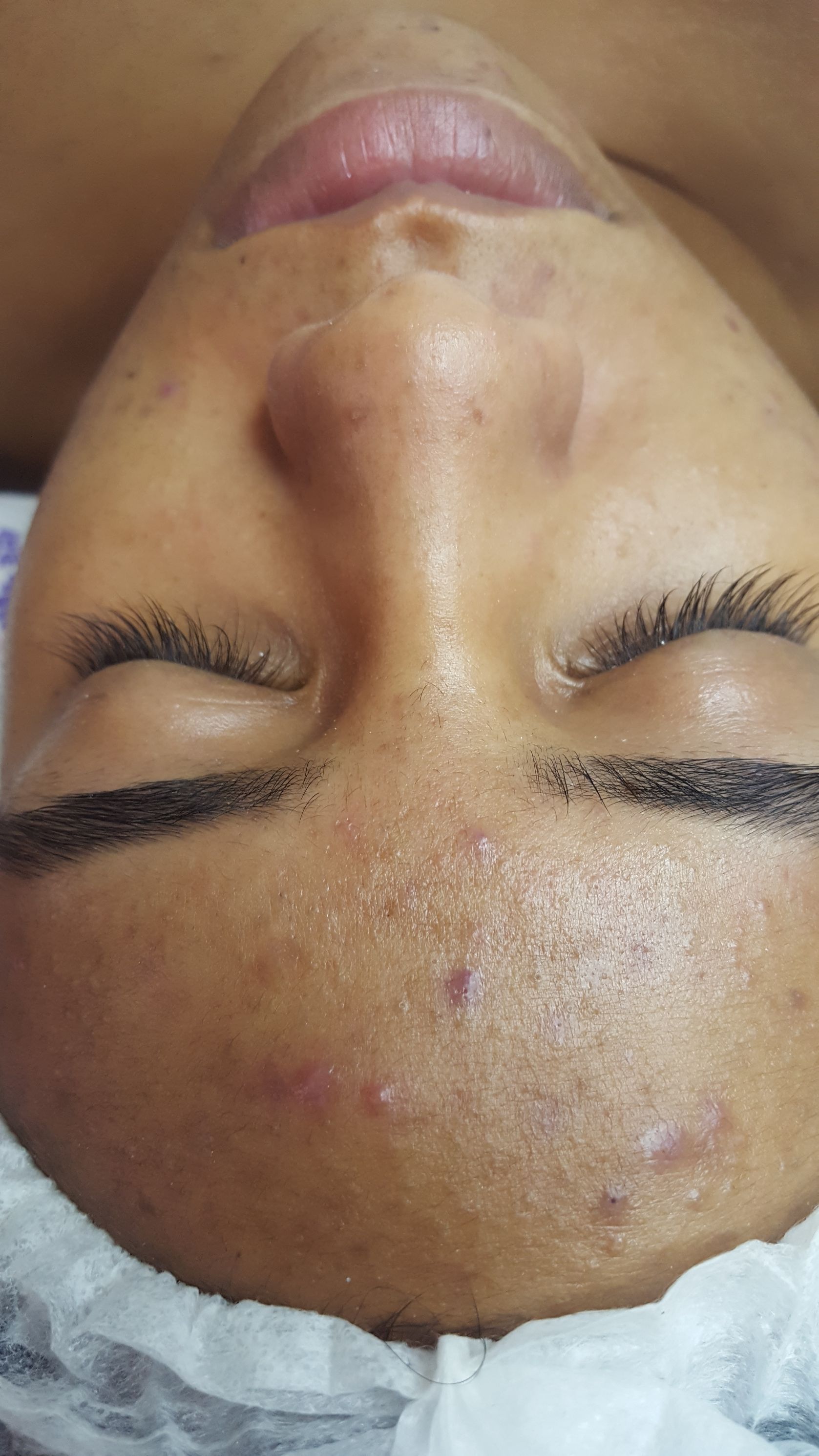 esteticista