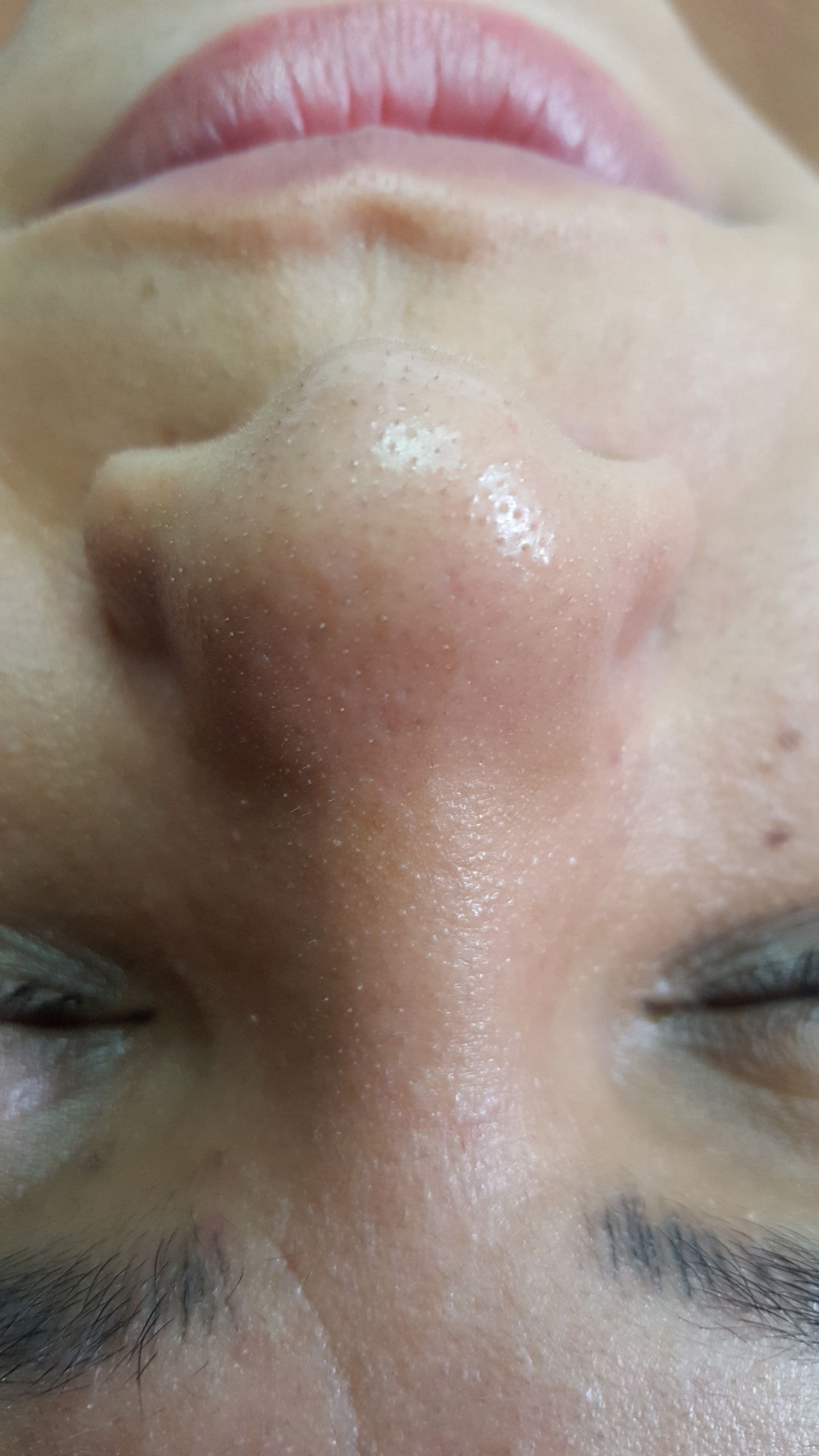 esteticista