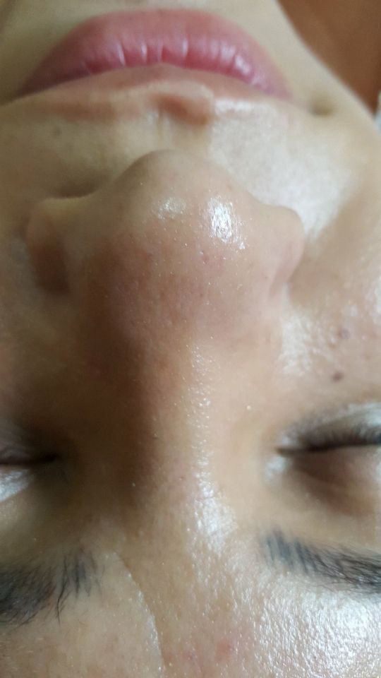 esteticista