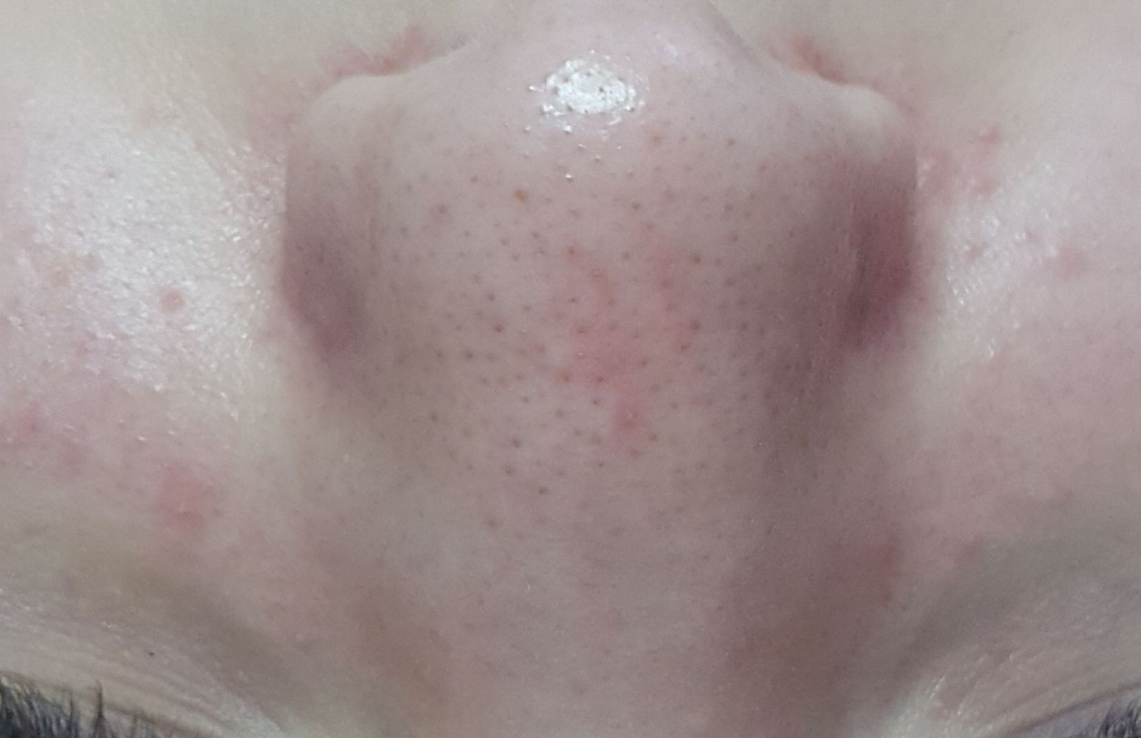 esteticista