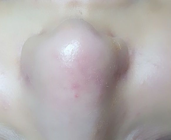 esteticista