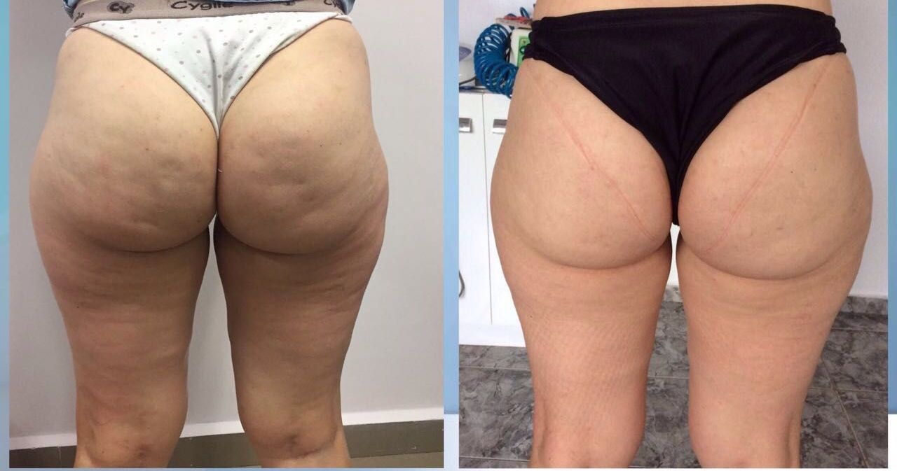 esteticista