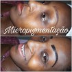 Micropigmentação