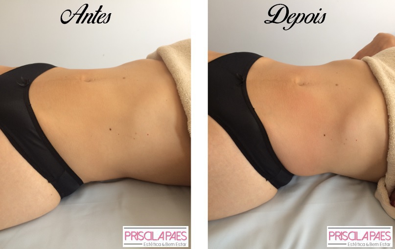 #priscilapaesesteticista #esteticacorporal #massagemmodeladora estética esteticista micropigmentador(a)